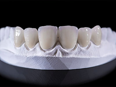 歯の白さを追求できる